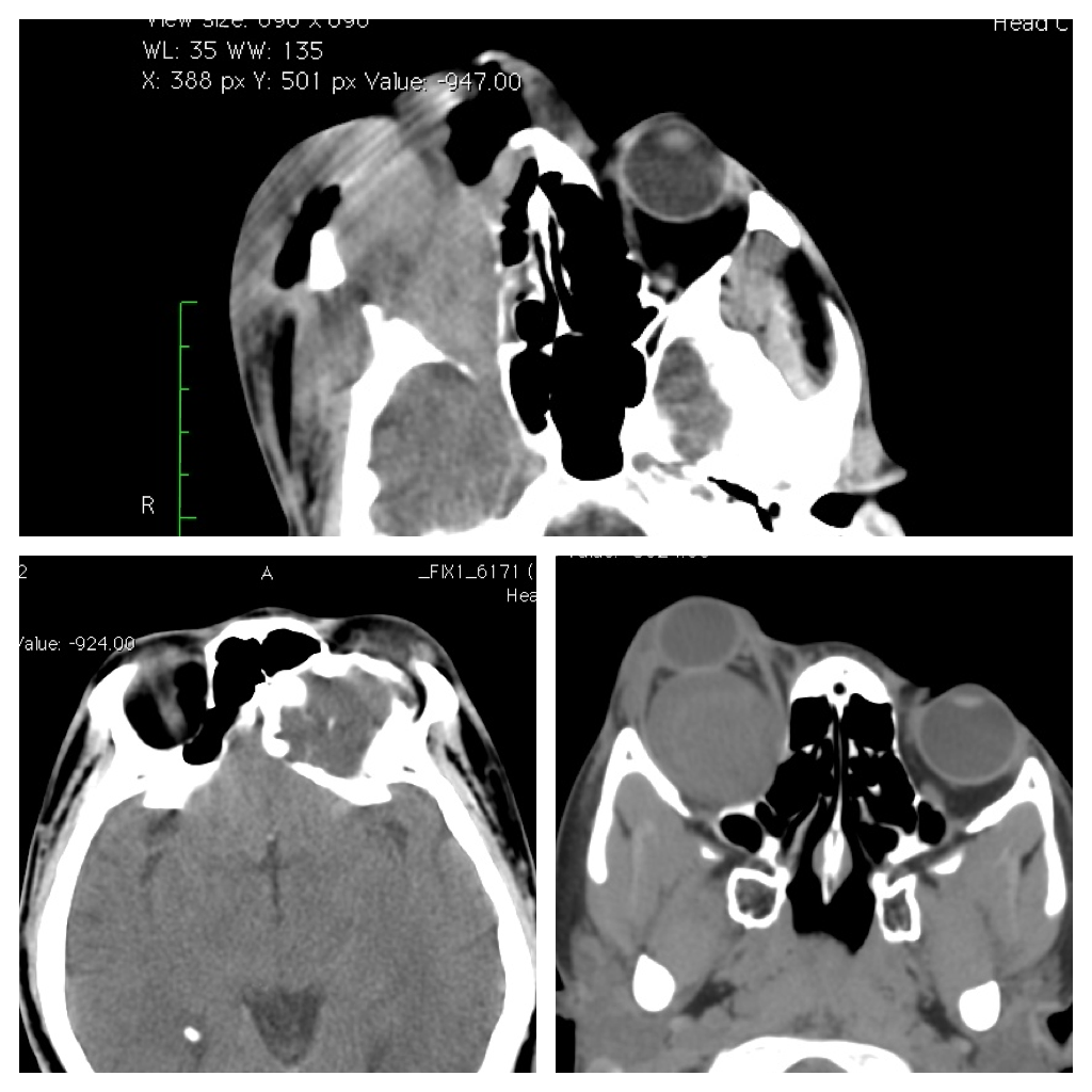orbital masses