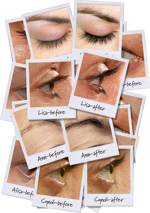 Latisse competitor rapidlash