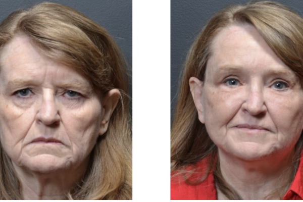 Cosmetic before-and-after photograph 1