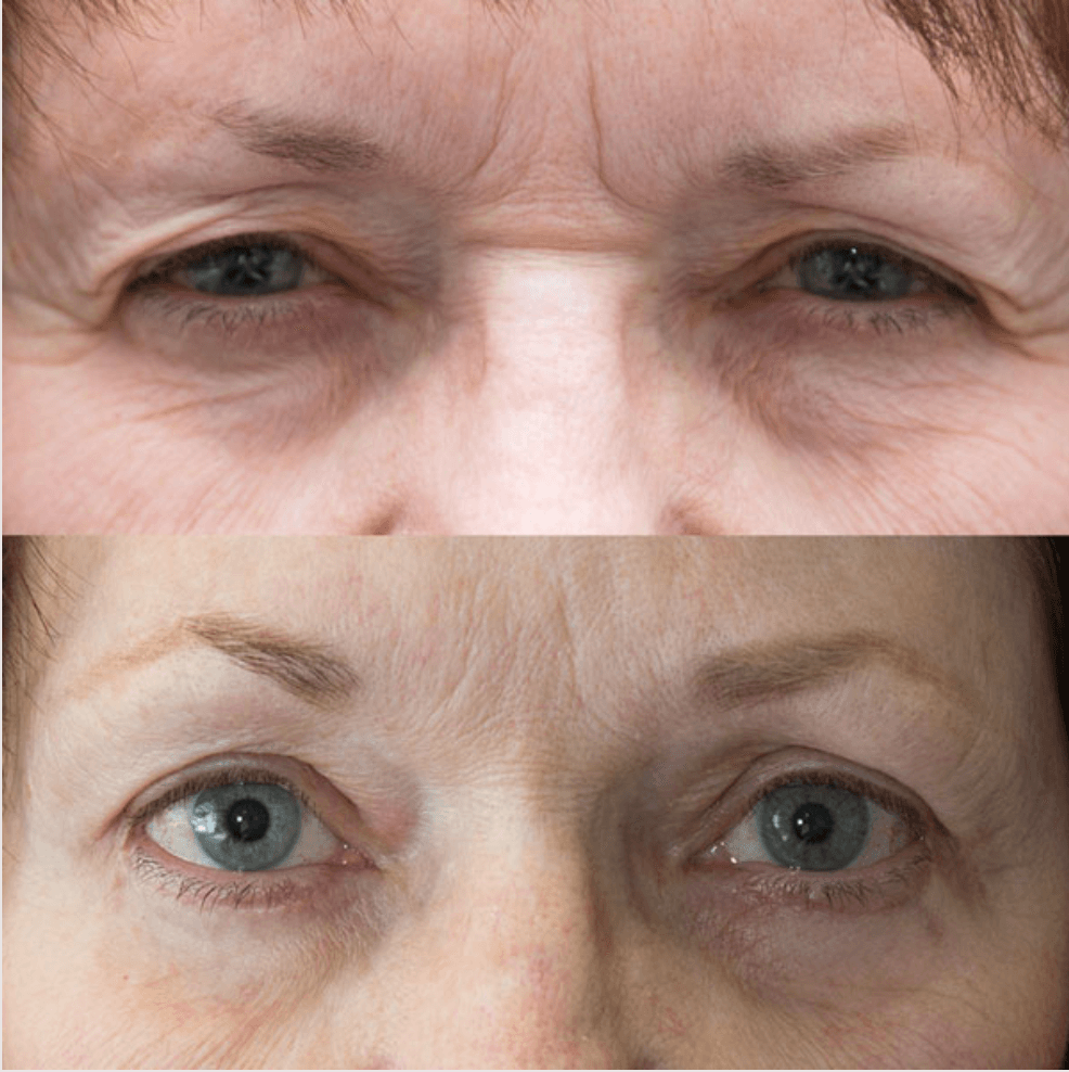 Cosmetic before-and-after photograph 18