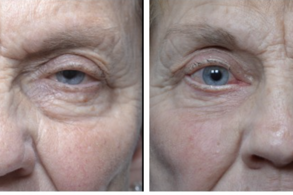 Medical before-and-after photograph 21