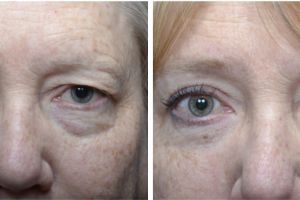 Medical before-and-after photograph 27