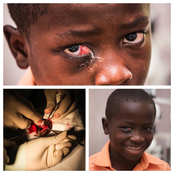 Child undergoing surgery