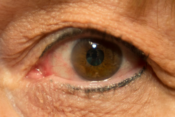 Eye with eyeliner