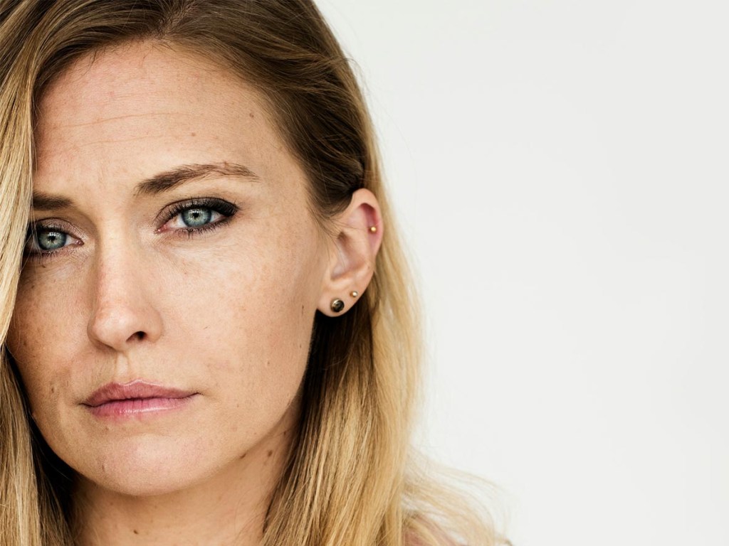 Close-up portrait of a woman with a serious expression and slightly hooded upper eyelids, illustrating the appearance of heavy eyelids that may affect vision or create a tired look.